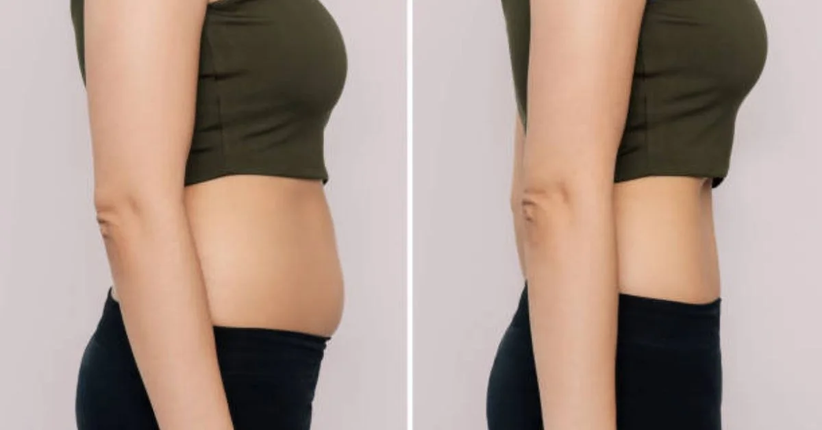 Lipo 360