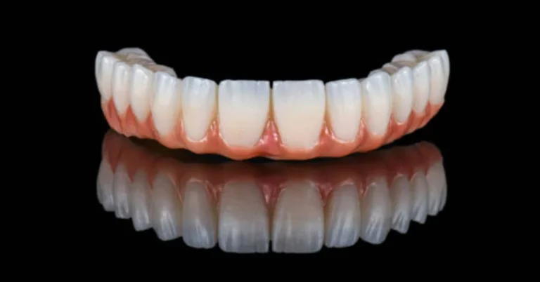 Zirconia Bridge