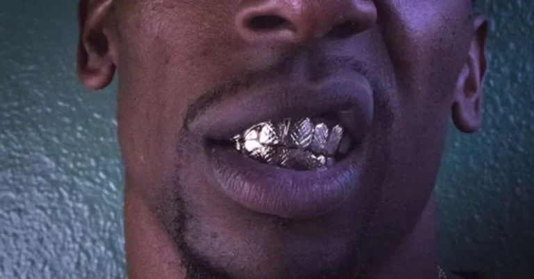 Kanye West Teeth