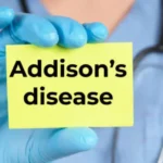 Adenoidid