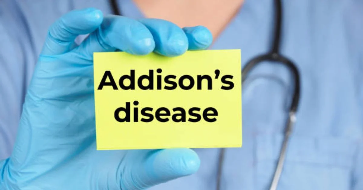 Adenoidid